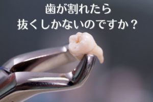 歯が割れたら抜くしかない？｜香川県高松市の吉本歯科医院