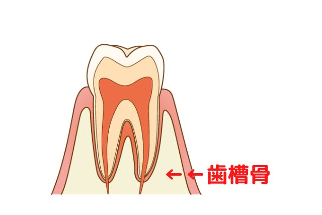 歯に縦にひび割れ｜高松市の吉本歯科医院